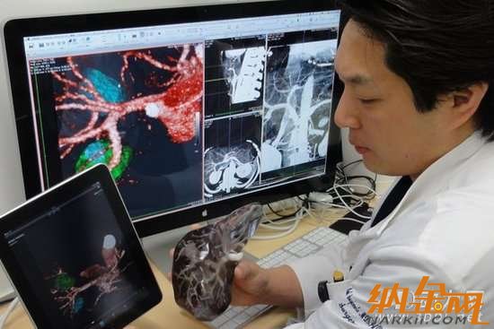 3D打印致手術臺